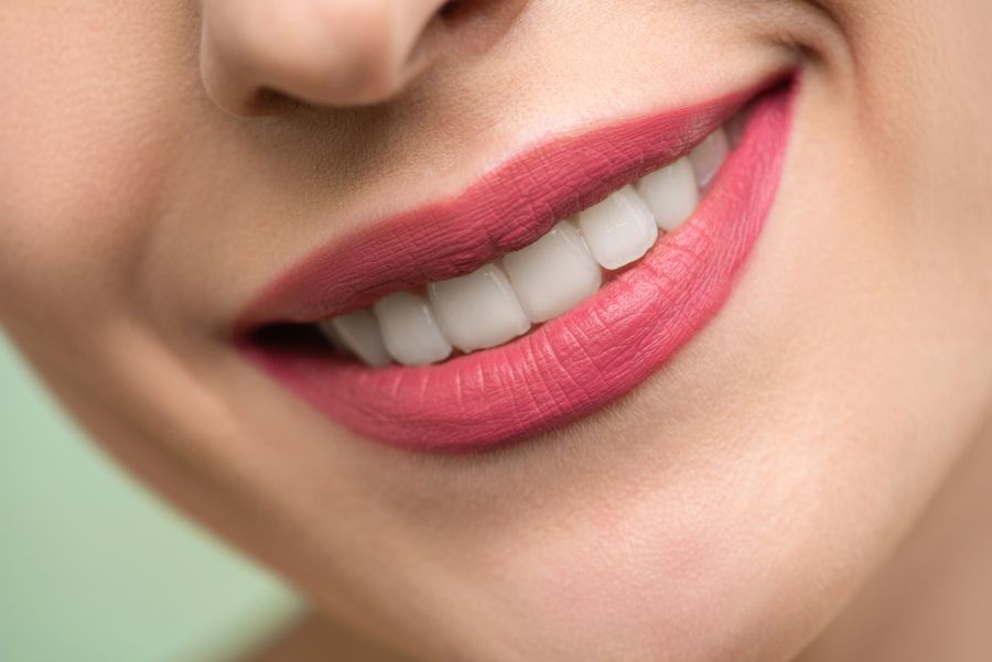 Close-up of a finished, natural-looking smile