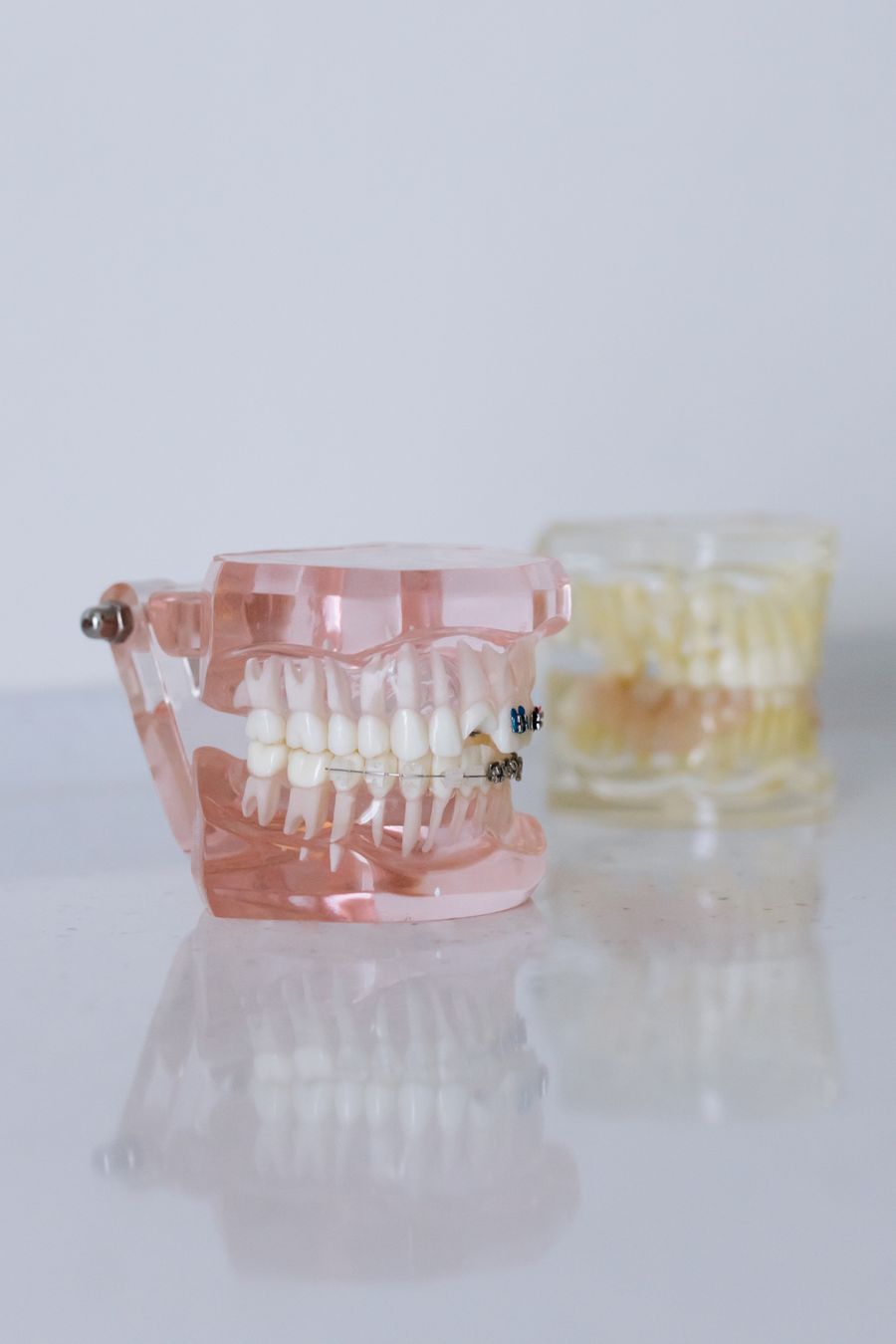 Denture models on the bench