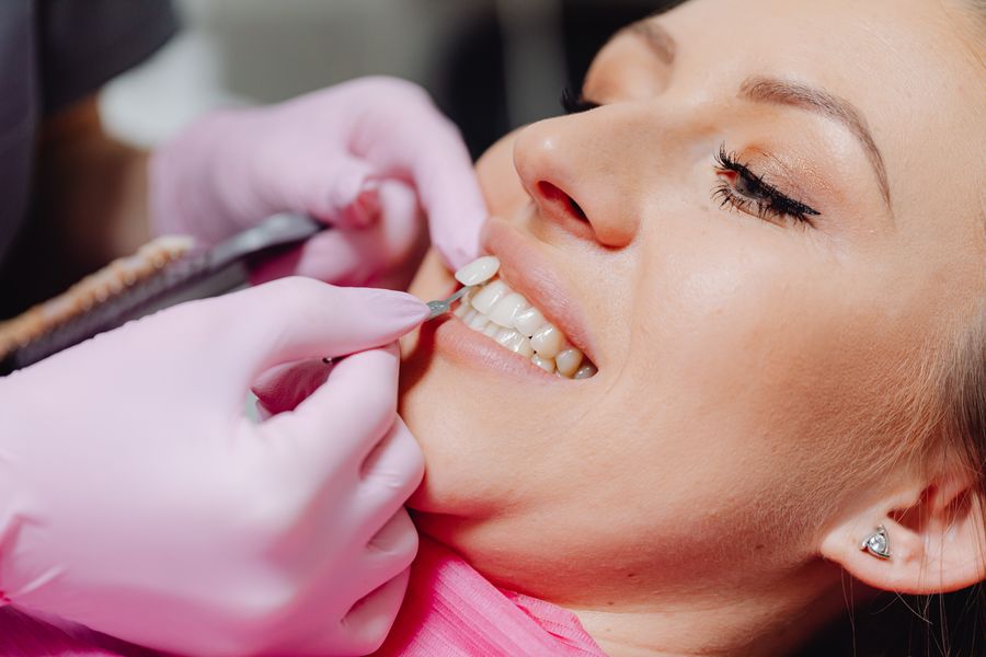 Veneer being placed on a prepared tooth